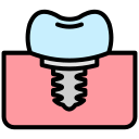 Dental Implants & Prosthetics